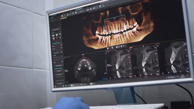 TMJ/TMD Treatment in Lakewood, IL